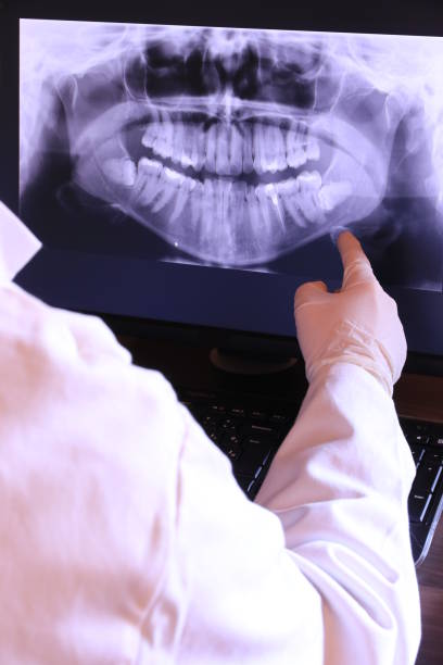 Best Emergency Treatment for Dental Infections or Abscesses in Arbuckle, CA