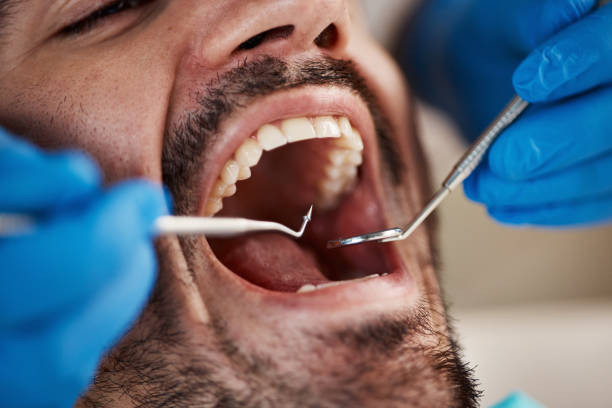 Best Urgent Care for Lost Fillings or Crowns in Arbuckle, CA